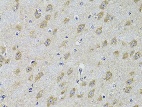 Immunohistochemistry - ADRBK2 Polyclonal Antibody 