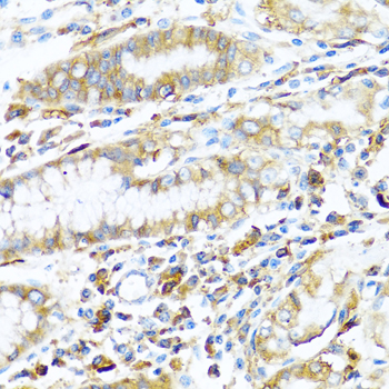 Immunohistochemistry - HLA-DPB1 Polyclonal Antibody 