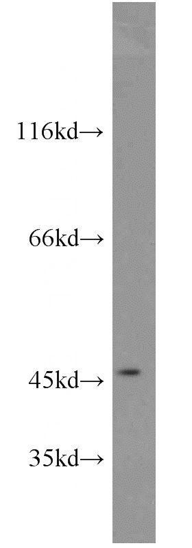 human heart tissue were subjected to SDS PAGE followed by western blot with Catalog No:110705(FOXO4 antibody) at dilution of 1:800