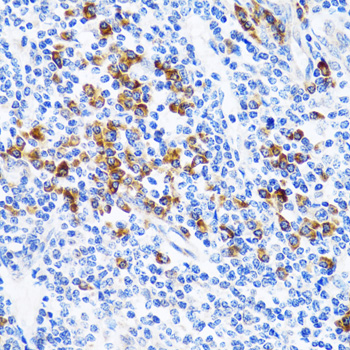 Immunohistochemistry - TNFSF12 Polyclonal Antibody 