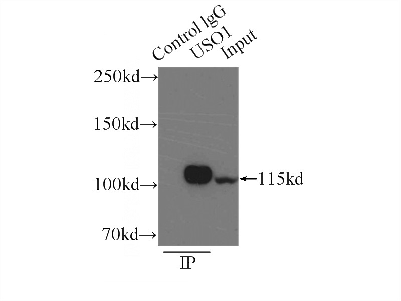 IP Result of anti-p115, USO1 (IP:Catalog No:113532, 3ug; Detection:Catalog No:113532 1:1500) with mouse brain tissue lysate 7000ug.