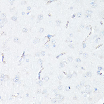 Immunohistochemistry - P Glycoprotein Polyclonal Antibody 