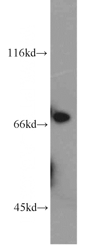 mouse thymus tissue were subjected to SDS PAGE followed by western blot with Catalog No:109442(COL23A1 antibody) at dilution of 1:800