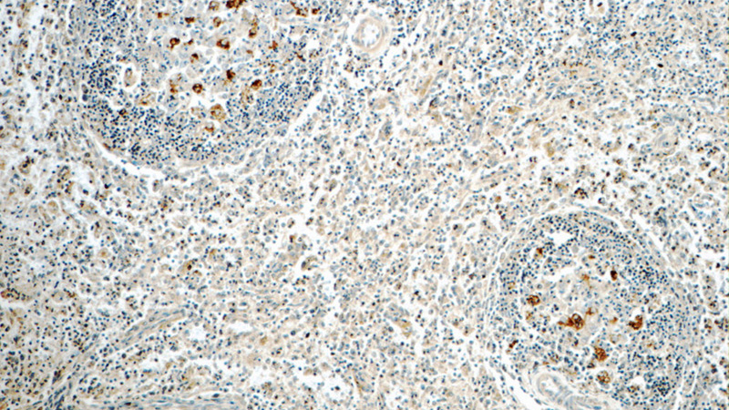 Immunohistochemistry of paraffin-embedded human spleen tissue slide using Catalog No:116844(WAS Antibody) at dilution of 1:50 (under 10x lens)