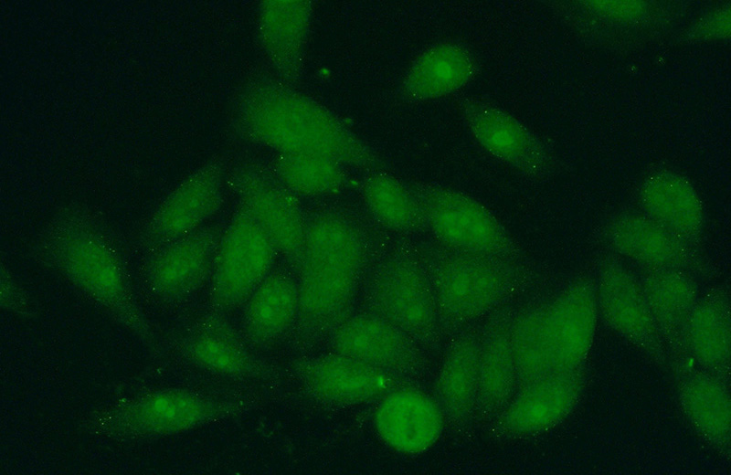 Immunofluorescent analysis of (10% Formaldehyde) fixed HeLa cells using Catalog No:108557(BXDC1 Antibody) at dilution of 1:50 and Alexa Fluor 488-congugated AffiniPure Goat Anti-Rabbit IgG(H+L)