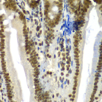 Immunohistochemistry - SF3B2 Polyclonal Antibody 