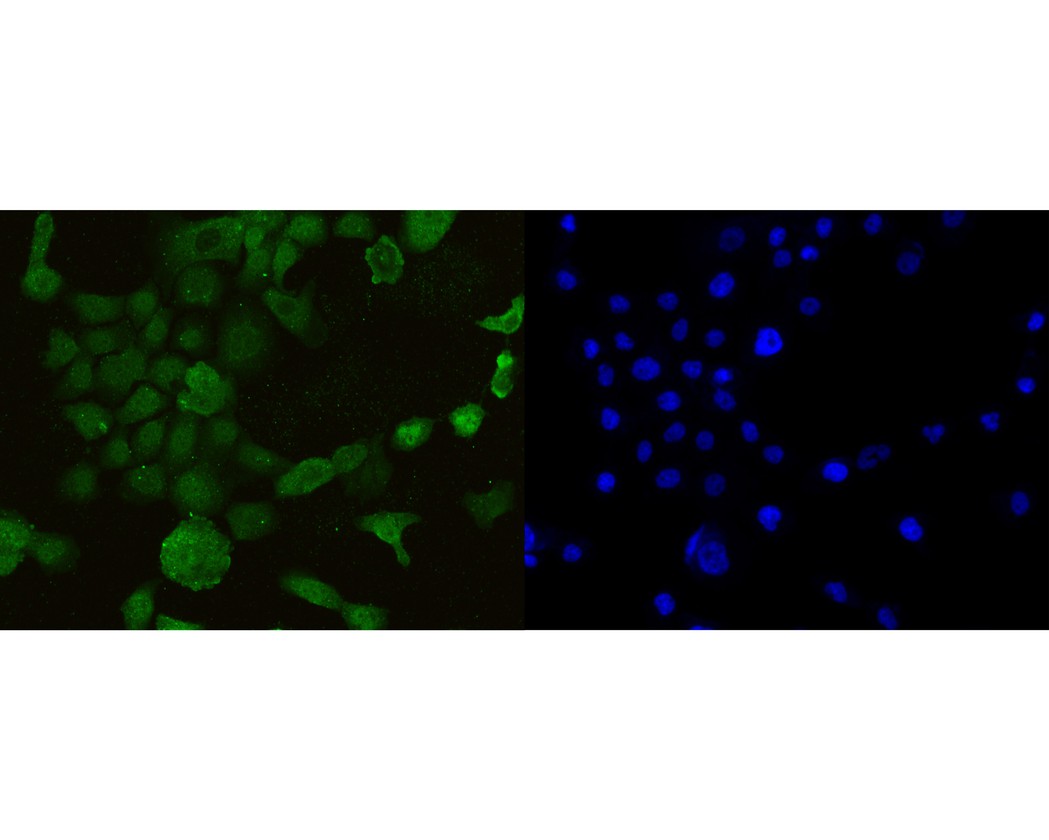 Fig2:; ICC staining of AIM2 in A431 cells (green). Formalin fixed cells were permeabilized with 0.1% Triton X-100 in TBS for 10 minutes at room temperature and blocked with 10% negative goat serum for 15 minutes at room temperature. Cells were probed with the primary antibody ( 1/50) for 1 hour at room temperature, washed with PBS. Alexa Fluor®488 conjugate-Goat anti-Rabbit IgG was used as the secondary antibody at 1/1,000 dilution. The nuclear counter stain is DAPI (blue).