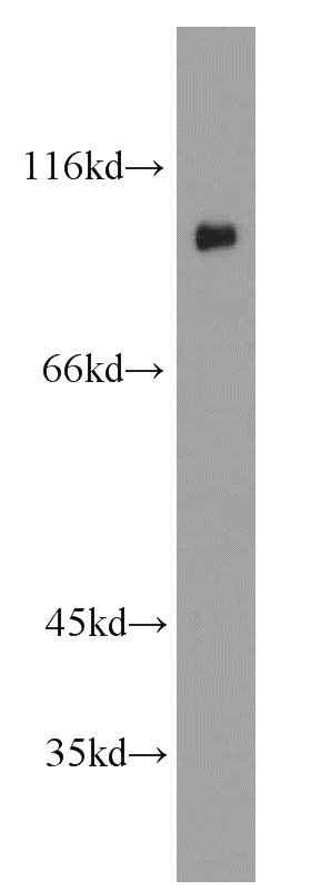 human brain tissue were subjected to SDS PAGE followed by western blot with Catalog No:108708(C21orf66 antibody) at dilution of 1:2000