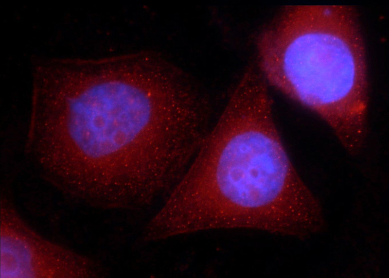Immunofluorescent analysis of HepG2 cells using Catalog No:109319(CIRBP Antibody) at dilution of 1:25 and Rhodamine-Goat anti-Rabbit IgG