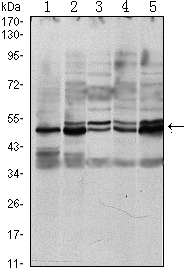Western blot analysis using SMAD3 mouse mAb against A549 (1), Hela (2), Jurkat (3), PC-2 (4) and NIH/3T3 (5) cell lysate.