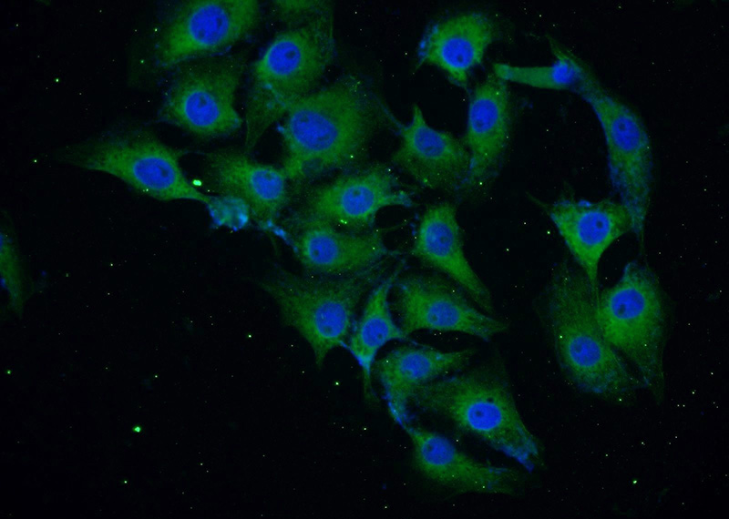 Immunofluorescent analysis of SH-SY5Y cells using Catalog No:107879(a-Synuclein Antibody) at dilution of 1:25 and Alexa Fluor 488-congugated AffiniPure Goat Anti-Rabbit IgG(H+L)
