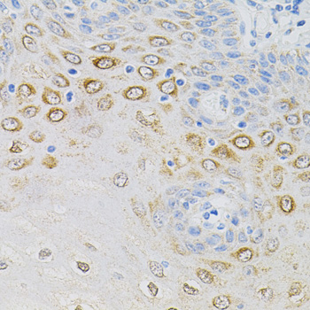 Immunohistochemistry - GNA13 Polyclonal Antibody 