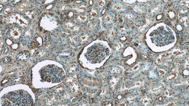 Immunohistochemistry of paraffin-embedded human kidney tissue slide using Catalog No:108249(ARF6-Specific Antibody) at dilution of 1:50 (under 10x lens)