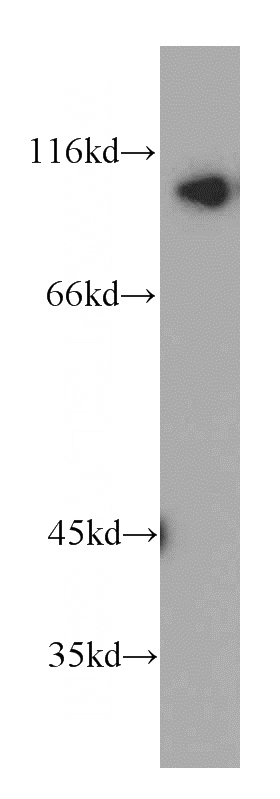 MCF7 cells were subjected to SDS PAGE followed by western blot with Catalog No:111814(INVS antibody) at dilution of 1:100