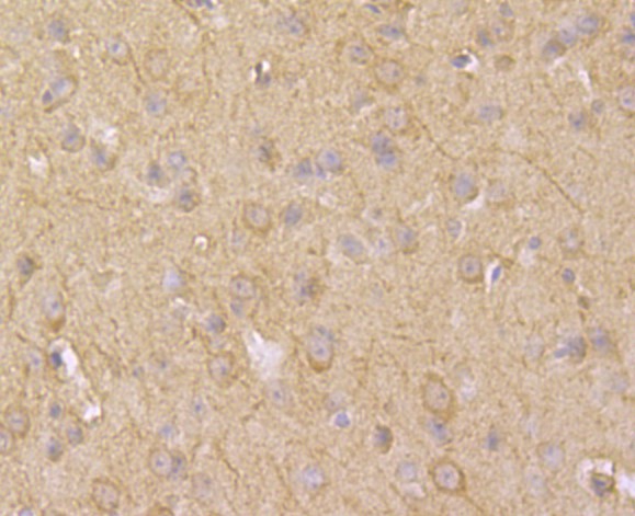 Fig3: Immunohistochemical analysis of paraffin-embedded mouse brain tissue using anti-ACCN2 antibody. Counter stained with hematoxylin.