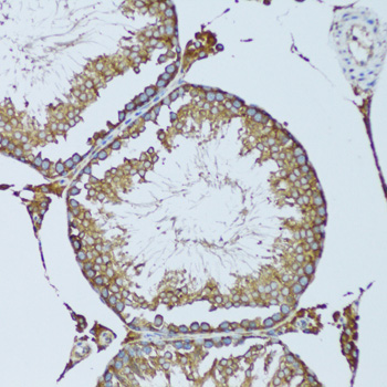 Immunohistochemistry - RPN1 Polyclonal Antibody 