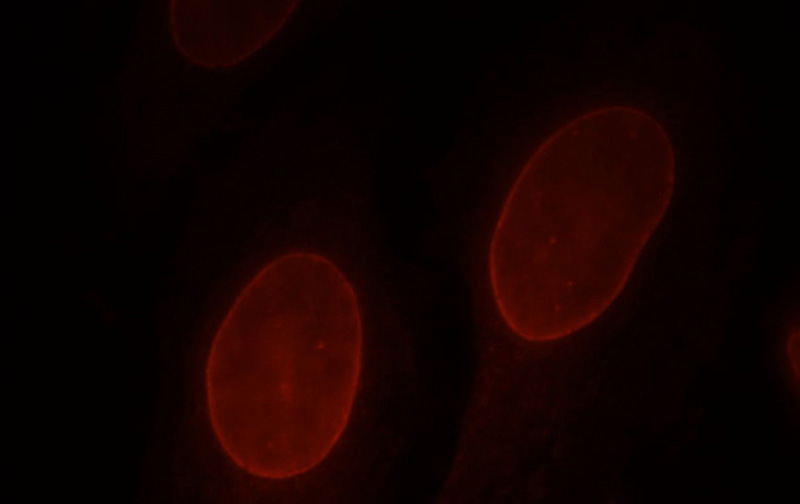 Immunofluorescent analysis of HepG2 cells, using LMNB2 antibody Catalog No:112282 at 1:25 dilution and Rhodamine-labeled goat anti-rabbit IgG (red).