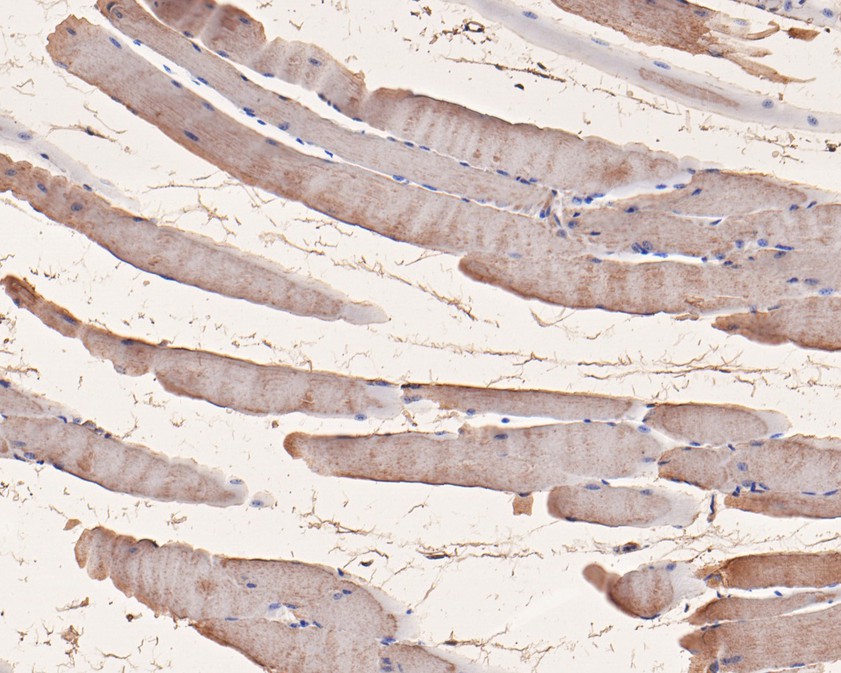 Fig2:; Immunohistochemical analysis of paraffin-embedded mouse skeletal muscle tissue using anti-ORP1 antibody. The section was pre-treated using heat mediated antigen retrieval with Tris-EDTA buffer (pH 9.0) for 20 minutes.The tissues were blocked in 5% BSA for 30 minutes at room temperature, washed with ddH; 2; O and PBS, and then probed with the primary antibody ( 1/50) for 30 minutes at room temperature. The detection was performed using an HRP conjugated compact polymer system. DAB was used as the chromogen. Tissues were counterstained with hematoxylin and mounted with DPX.