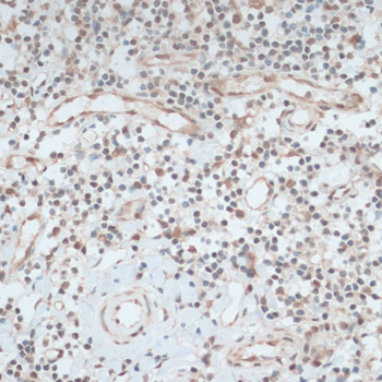 Immunohistochemistry - ZNF416 Polyclonal Antibody 