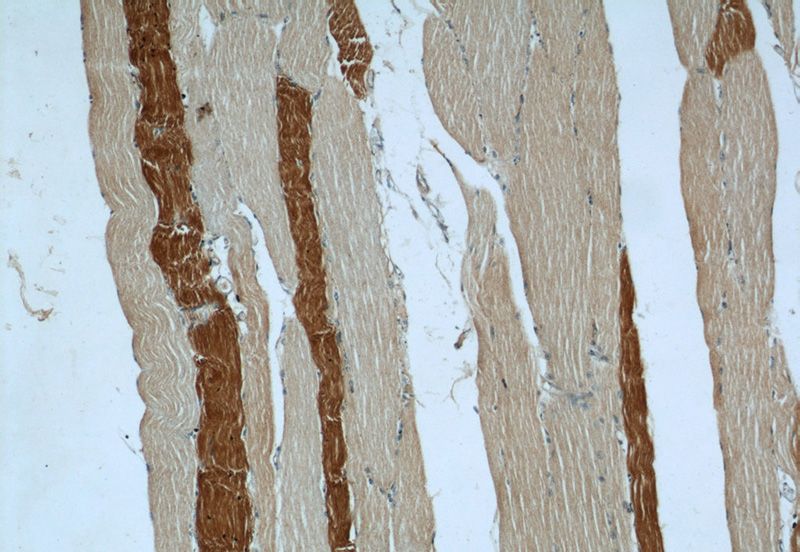 Immunohistochemical of paraffin-embedded human skeletal muscle using Catalog No:107732(ACACA antibody) at dilution of 1:50 (under 10x lens)