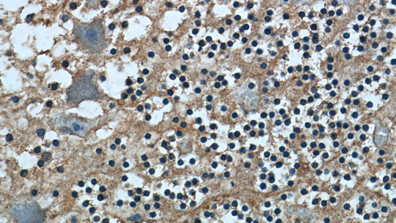 Immunohistochemistry of paraffin-embedded human cerebellum tissue slide using Catalog No:111579(HYDIN Antibody) at dilution of 1:50 (under 40x lens)