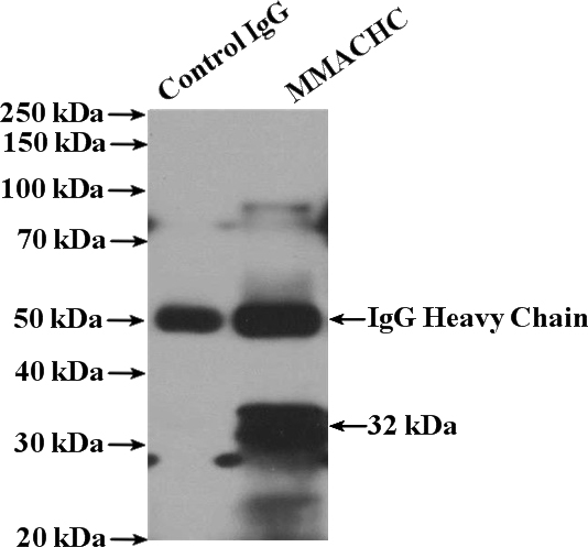 IP Result of anti-DKK2 (IP:Catalog No:109983, 4ug; Detection:Catalog No:109983 1:300) with mouse skeletal muscle tissue lysate 4000ug.