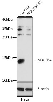 Western blot - NDUFB4 Polyclonal Antibody 