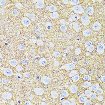 Immunohistochemistry - SLC1A2 Polyclonal Antibody 