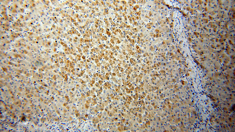 Immunohistochemical of paraffin-embedded human liver using Catalog No:110361(ERK1/2 antibody) at dilution of 1:100 (under 10x lens)