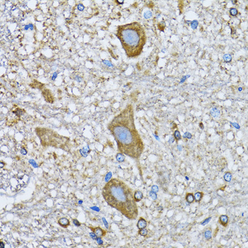 Immunohistochemistry - HDAC5 Polyclonal Antibody 