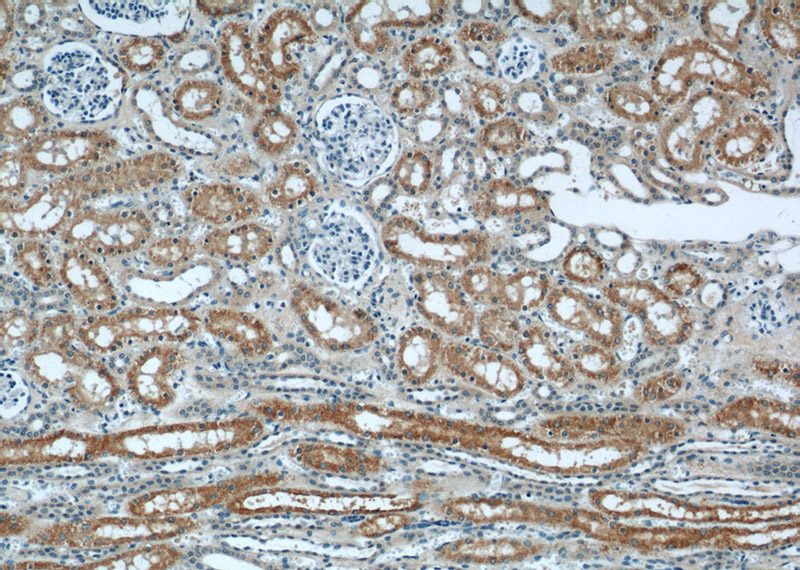 Immunohistochemical of paraffin-embedded human kidney using Catalog No:107278(IFT88 antibody) at dilution of 1:50 (under 10x lens)