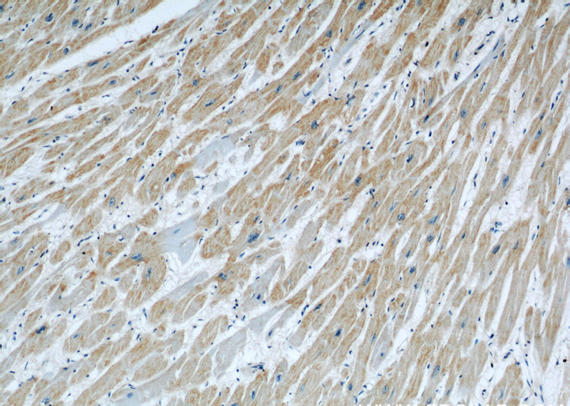 Immunohistochemical of paraffin-embedded human heart using Catalog No:116782(PIK3C3 antibody) at dilution of 1:50 (under 10x lens)