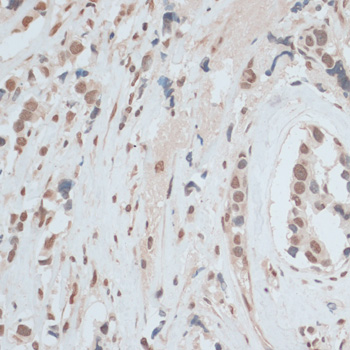 Immunohistochemistry - ZNF574 Polyclonal Antibody 