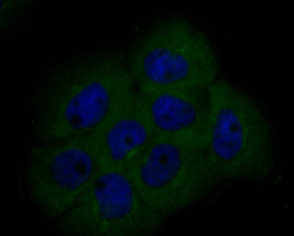 Fig2: ICC staining of BCL2L12 in A431 cells (green). Formalin fixed cells were permeabilized with 0.1% Triton X-100 in TBS for 10 minutes at room temperature and blocked with 1% Blocker BSA for 15 minutes at room temperature. Cells were probed with the primary antibody ( 1/100) for 1 hour at room temperature, washed with PBS. Alexa Fluor®488 Goat anti-Rabbit IgG was used as the secondary antibody at 1/1,000 dilution. The nuclear counter stain is DAPI (blue).