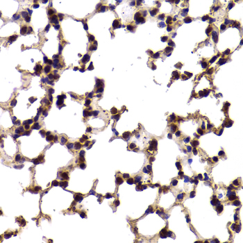 Immunohistochemistry - SF1 Polyclonal Antibody 