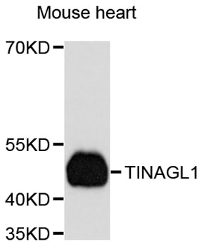 Western blot - TINAGL1 Polyclonal Antibody 