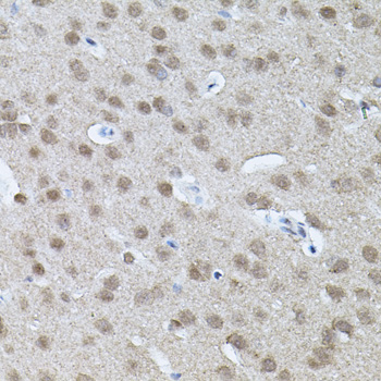 Immunohistochemistry - RNF166 Polyclonal Antibody 