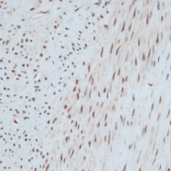 Immunohistochemistry - ZNF433 Polyclonal Antibody 