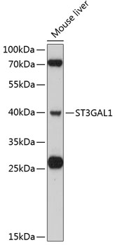 Western blot - ST3GAL1 Polyclonal Antibody 