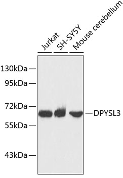 Western blot - DPYSL3 Polyclonal Antibody 