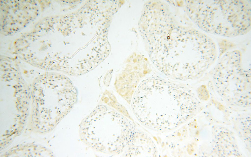 Immunohistochemical of paraffin-embedded human testis using Catalog No:112519(METTL4 antibody) at dilution of 1:100 (under 10x lens)