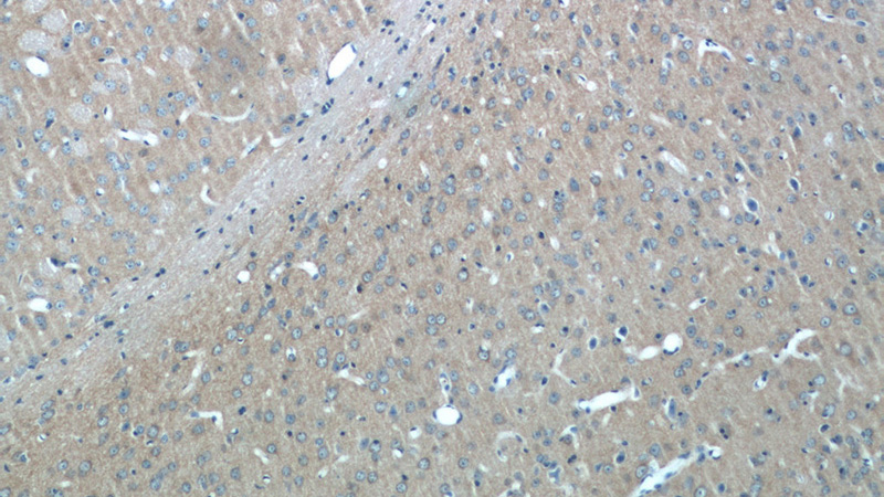 Immunohistochemistry of paraffin-embedded mouse brain tissue slide using Catalog No:108315(ATP6V1G2 Antibody) at dilution of 1:50 (under 10x lens)
