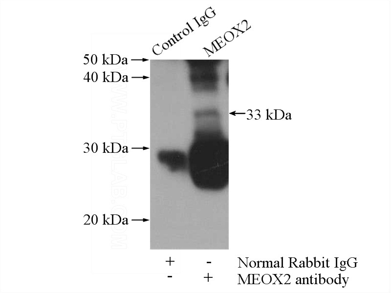 IP Result of anti-MEOX2 (IP:Catalog No:112654, 4ug; Detection:Catalog No:112654 1:300) with human placenta tissue lysate 1520ug.
