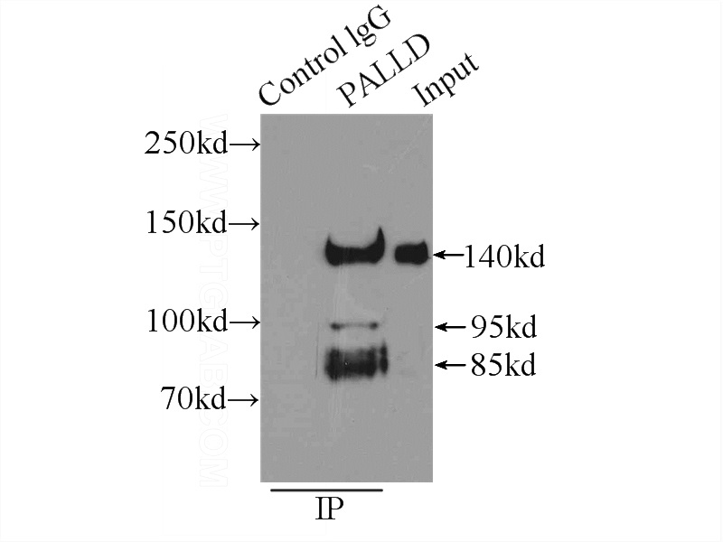IP Result of anti-PALLD,palladin (IP:Catalog No:113503, 4ug; Detection:Catalog No:113503 1:2000) with HeLa cells lysate 1800ug.