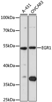 Western blot - EGR1 Polyclonal Antibody 
