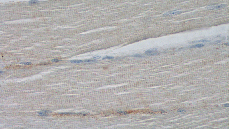 Immunohistochemistry of paraffin-embedded human skeletal muscle tissue slide using Catalog No:112994(MYOM3 Antibody) at dilution of 1:200 (under 40x lens).