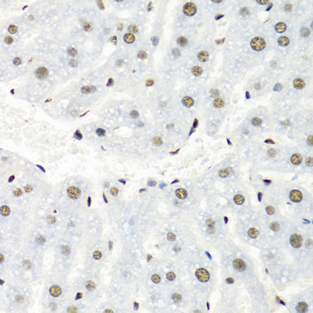 Immunohistochemistry - HNRNPR Polyclonal Antibody 