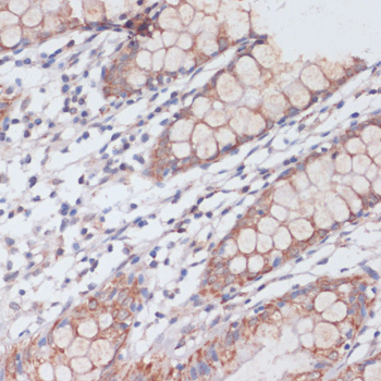 Immunohistochemistry - MBTPS1 Polyclonal Antibody 