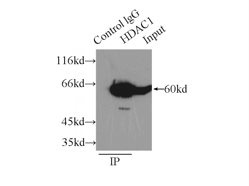 IP Result of anti-HDAC1 (IP:Catalog No:111370, 3ug; Detection:Catalog No:111370 1:500) with mouse testis tissue lysate 10000ug.