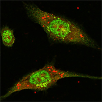 Confocal immunofluorescence analysis of Eca-109 cells using ERK2 mouse mAb (green).
